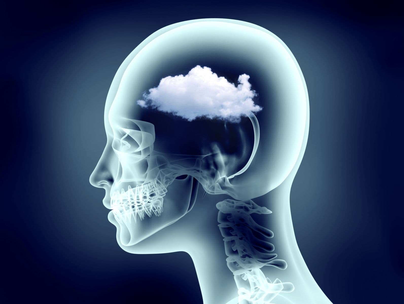 brain fog and the upper cervical spine