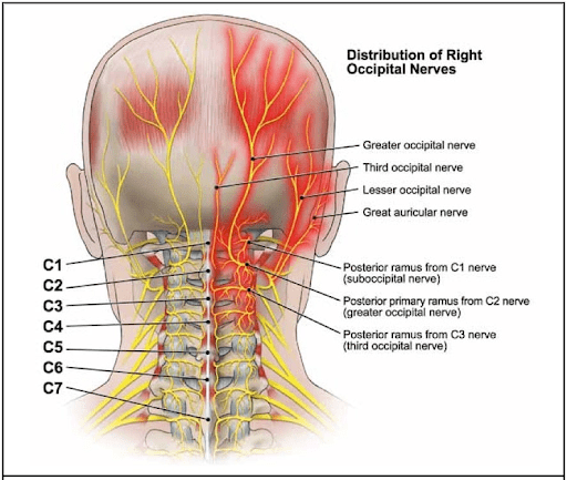 Occipital neuralgia 2